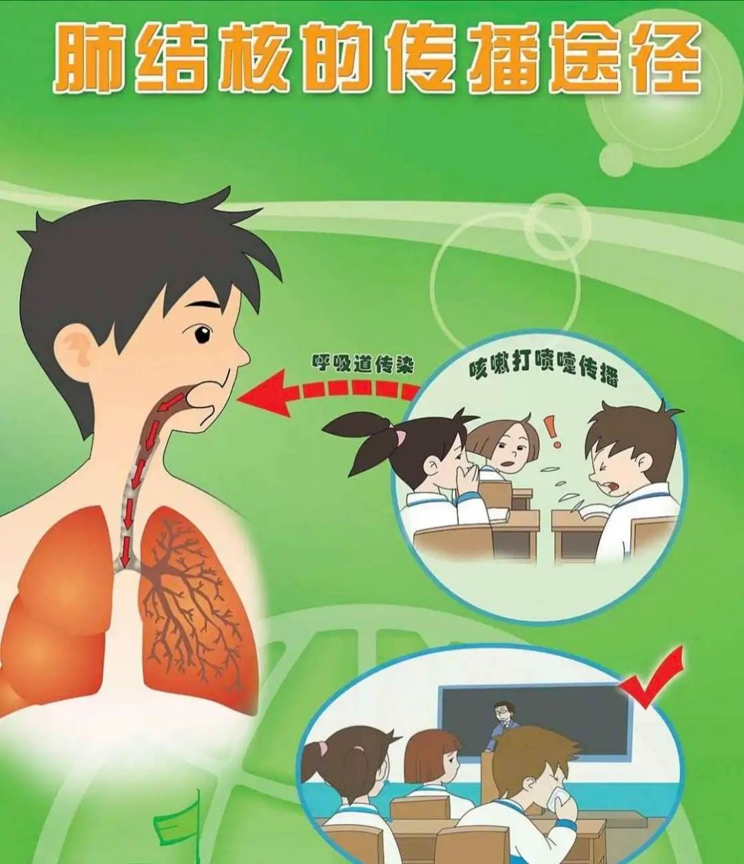 结核病2.webp.jpg